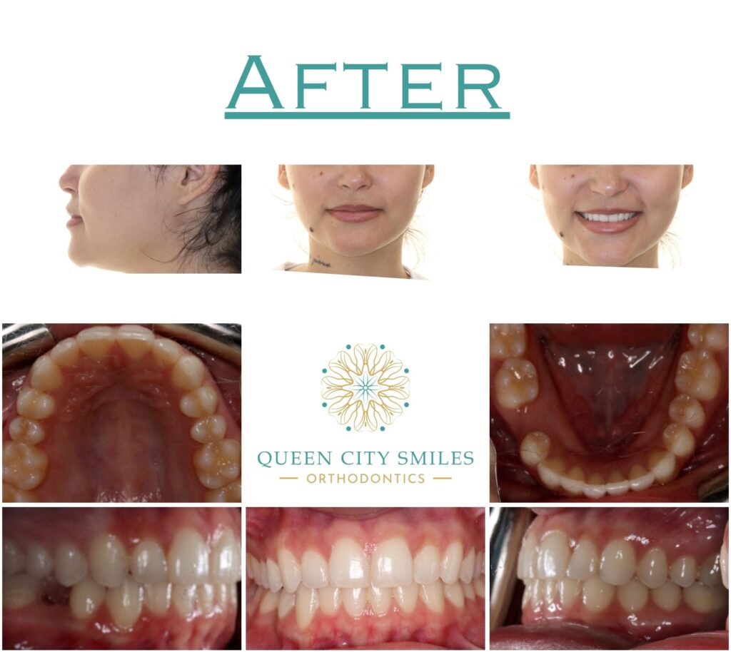 244 After Treatment