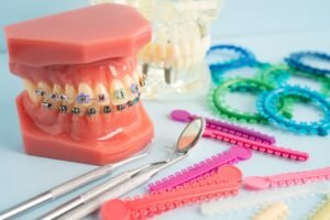 Orthodontic ligatures rings and ties, elastic rubber bands on orthodontic braces, model for dentist studying about dentistry.
