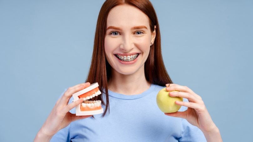 braces-food-care Smiling redhead beauty with braces, clutching a dental jaw model and an apple, isolated on a blue background. Emphasizes dental health concept