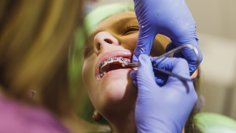 Teenage girl is at the dentist. She sits in the dentist's chair and the dentist sets braces on her teeth.